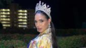 Ex-Miss Venezuela morre aos 24 anos aps cirurgia na boca